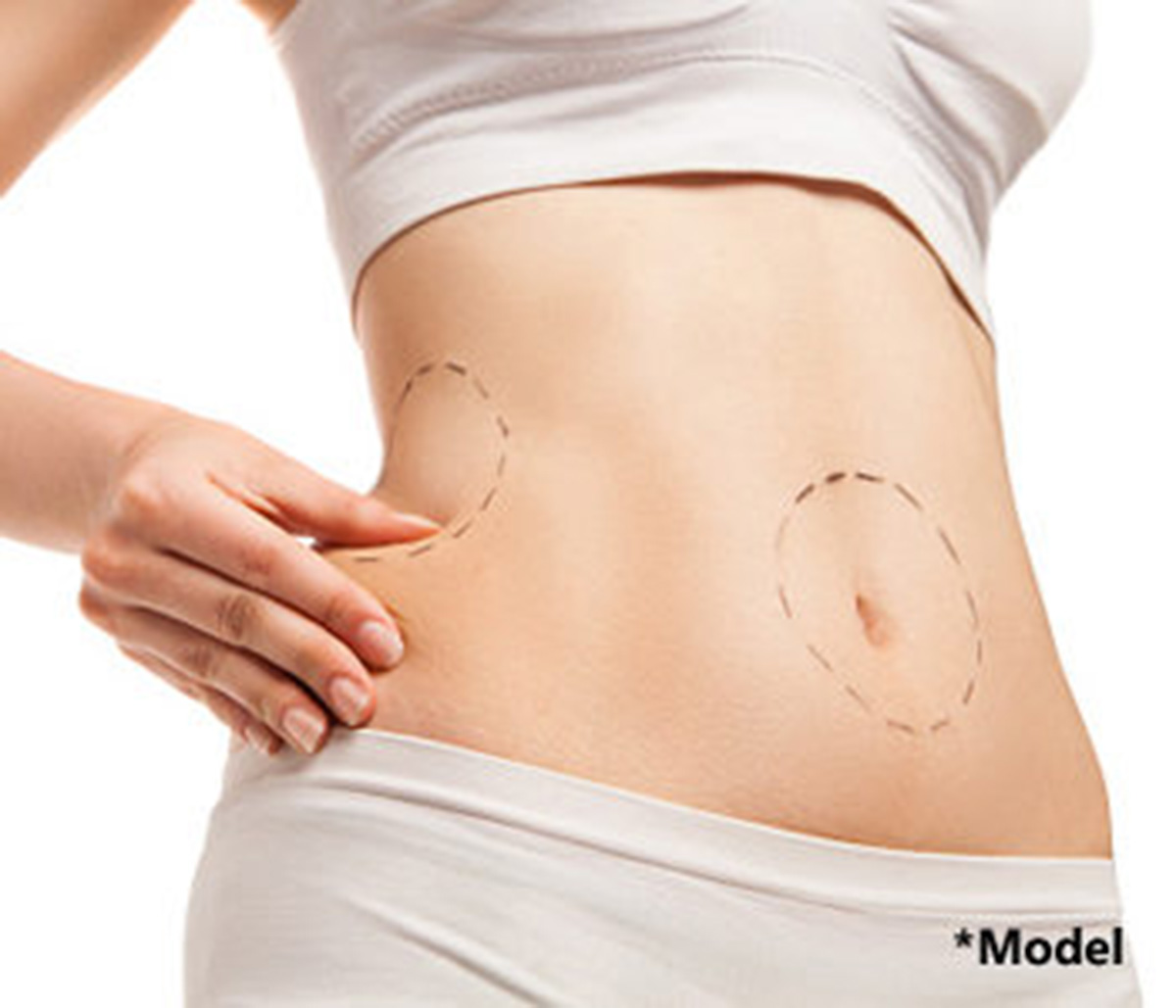 SmartLipo provide skin tightening benefits in Beverly Hills